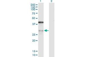 Western Blot analysis of ASPH expression in transfected 293T cell line by ASPH MaxPab polyclonal antibody. (Aspartate beta Hydroxylase anticorps  (AA 1-270))