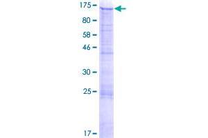 Matrilin 2 (MATN2) (AA 1-937) protein (GST tag)
