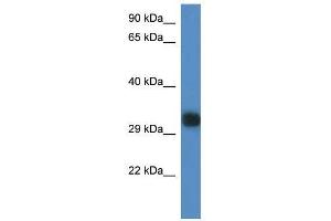 Western Blot showing Gm527 antibody used at a concentration of 1. (GM527 anticorps  (C-Term))