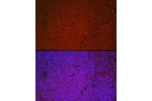 Immunofluorescence analysis of mouse spleen cells using ETS1 Rabbit pAb (ABIN7271258) at dilution of 1:100 (40x lens).