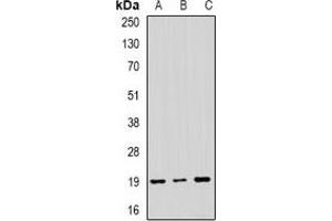 Western blot analysis of NAT13 expression in SKOV3 (A), MCF7 (B), mouse brain (C) whole cell lysates. (NAA50 anticorps)