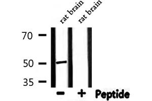 Western blot analysis of extracts from rat brain, using PSMD12 Antibody.