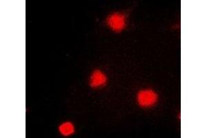 Immunofluorescent analysis of NAT5 staining in A549 cells. (NAT5 anticorps)