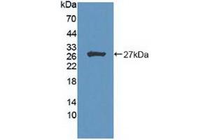 Western blot analysis of recombinant Human HIPK2. (HIPK2 anticorps  (AA 977-1198))