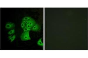 Immunofluorescence analysis of A549 cells, using EDG6 Antibody. (S1PR4 anticorps  (AA 211-260))