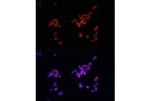 Immunofluorescence analysis of PC-12 cells using Phospho-Smad2-S465/467 + Smad3-S423/425 antibody (ABIN6135314, ABIN6136248, ABIN6136249 and ABIN6225575) at dilution of 1:100. (SMAD2 / SMAD3 (pSer423), (pSer425) anticorps)