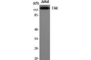 Western Blot (WB) analysis of specific cells using FAK Polyclonal Antibody. (FAK anticorps  (Thr446))