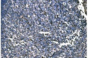 IHC analysis of PKM2 using anti-PKM2 antibody (ABIN3043381). (PKM anticorps  (N-Term))