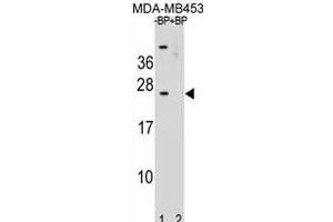 Western blot analysis of SSX6 Antibody (Center) Pab (ABIN1881838 and ABIN2839021) pre-incubated without(lane 1) and with(lane 2) blocking peptide in MDA-M cell line lysate. (SSX6 anticorps  (AA 62-91))