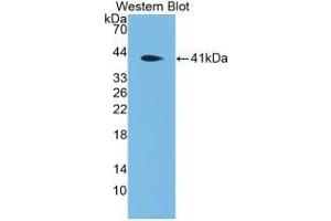 Detection of Recombinant DEFa4, Mouse using Polyclonal Antibody to Defensin Alpha 4, Corticostatin (DEFa4)