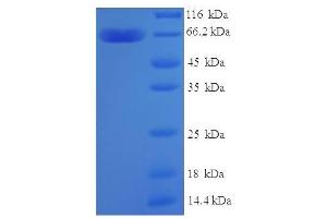 SDS-PAGE (SDS) image for Zinc Finger Protein 114 (ZNF114) (AA 1-414), (partial) protein (His-SUMO Tag) (ABIN5710642)