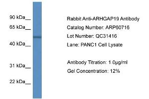 Western Blotting (WB) image for anti-rho GTPase Activating Protein 19 (ARHGAP19) (C-Term) antibody (ABIN2788551) (ARHGAP19 anticorps  (C-Term))