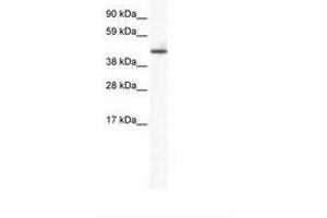 Image no. 1 for anti-Zinc Finger Protein 557 (ZNF557) (AA 298-347) antibody (ABIN6736004) (ZNF557 anticorps  (AA 298-347))