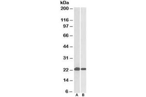 Western blot testing of HeLa [A] and Jurkat [B] lysates with DJ-1 antibody at 0. (PARK7/DJ1 anticorps)