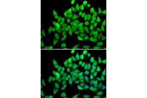 Immunofluorescence analysis of A549 cell using ALS2 antibody. (ALS2 anticorps)