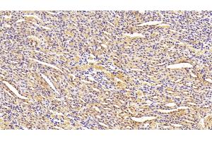 Detection of ANGPTL4 in Rat Kidney Tissue using Polyclonal Antibody to Angiopoietin Like Protein 4 (ANGPTL4)