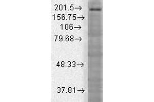 Shank3 Brain Membrane Western Blotting.