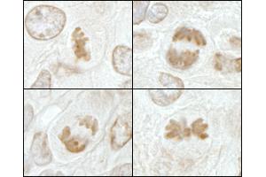 Immunohistochemistry (IHC) image for anti-Kinesin Family Member 2C (KIF2C) (AA 50-100) antibody (ABIN7448647) (KIF2C anticorps  (AA 50-100))