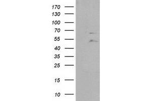Western Blotting (WB) image for anti-Protein tyrosine Phosphatase, Non-Receptor Type 11 (PTPN11) antibody (ABIN1500499) (PTPN11 anticorps)