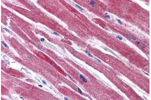 Human Heart: Formalin-Fixed, Paraffin-Embedded (FFPE)