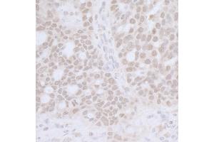 anti-RNA Polymerase-Associated Protein CTR9 Homolog (CTR9) (AA 1123-1173) antibody