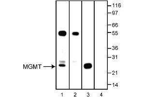 Image no. 2 for anti-O6-Methylguanine-DNA-Methyltransferase (MGMT) antibody (ABIN967567) (MGMT anticorps)