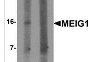 Western blot analysis of MEIG1 in human kidney tissue lysate with MEIG1 antibody at 1 μg/ml in (left) the absence and (right) the presence of blocking peptide. (MEIG1 anticorps  (C-Term))