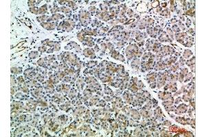 Immunohistochemical analysis of paraffin-embedded human-pancreas, antibody was diluted at 1:200 (MIA2 anticorps  (AA 361-410))