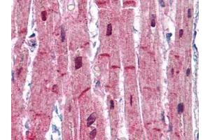 Human Heart: Formalin-Fixed, Paraffin-Embedded (FFPE) (ACTN2 anticorps)