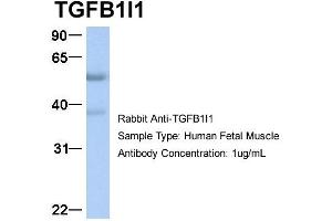 Host:  Rabbit  Target Name:  TGFB1I1  Sample Type:  Human Fetal Muscle  Antibody Dilution:  1. (TGFB1I1 anticorps  (Middle Region))