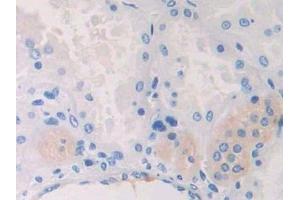 Detection of CAPN2 in Human Kidney Tissue using Polyclonal Antibody to Calpain 2 (CAPN2) (Calpain 2 anticorps  (AA 45-514))