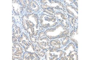 Immunohistochemistry (IHC) image for anti-Macrophage Migration Inhibitory Factor (Glycosylation-Inhibiting Factor) (MIF) (AA 2-115) antibody (ABIN7449528)