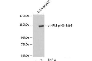 Western blot analysis of extracts of MDA-MB435 cells using Phospho-NFkB p100(S866) Polyclonal Antibody.