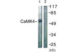 Western blot analysis of extracts from K562 cells, treated with H2O2 100uM 30', using CaMK4 (Ab-196/200) Antibody. (CAMK4 anticorps  (AA 166-215))