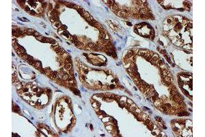 Image no. 2 for anti-Proteasome (Prosome, Macropain) Subunit, beta Type, 9 (Large Multifunctional Peptidase 2) (PSMB9) (AA 21-219) antibody (ABIN1491194)