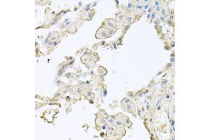 Immunohistochemistry of paraffin-embedded human lung using MMRN1 antibody (ABIN5974009) at dilution of 1/100 (40x lens). (Multimerin 1 anticorps)