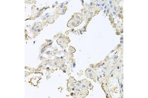 Immunohistochemistry of paraffin-embedded human lung using MMRN1 antibody (ABIN5974009) at dilution of 1/100 (40x lens).