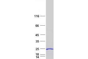 Validation with Western Blot