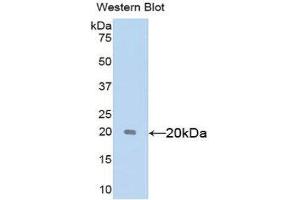 Western Blotting (WB) image for anti-Sex Hormone Binding Globulin (SHBG) (AA 222-358) antibody (ABIN1172841) (SHBG anticorps  (AA 222-358))