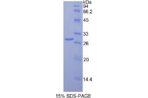 SDS-PAGE analysis of Rat Multimerin 1 Protein. (Multimerin 1 Protein (MMRN1))
