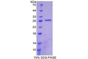 SDS-PAGE (SDS) image for Islet Cell Autoantigen 1, 69kDa (ICA1) (AA 1-258) protein (His tag) (ABIN1099216) (ICA1 Protein (AA 1-258) (His tag))