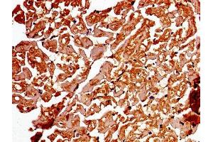 Immunohistochemistry of paraffin-embedded human heart tissue using ABIN7142886 at dilution of 1:100 (ADAMTS4 anticorps  (AA 213-319))