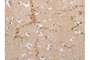 The image on the left is immunohistochemistry of paraffin-embedded Human brain tissue using ABIN7191581(NCAN Antibody) at dilution 1/30, on the right is treated with synthetic peptide.