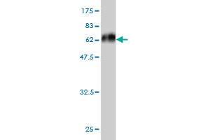 Western Blot detection against Immunogen (59. (MEOX2 anticorps  (AA 1-303))