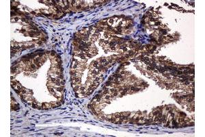 Image no. 3 for anti-Pogo Transposable Element with KRAB Domain (POGK) antibody (ABIN1500329)