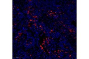 Immunofluorescence of paraffin embedded rat spleen using MS4A2 (ABIN7074594) at dilution of 1: 400 (250x lens)