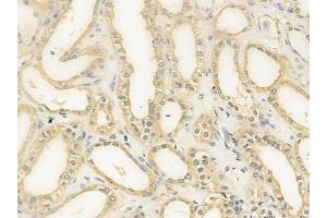 ABIN6257089 and ABIN6276147 at 1/100 staining human normal kidney tissue by IHC-P.