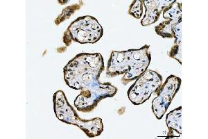 IHC analysis of MRE11 using anti-MRE11 antibody (ABIN7601056). (Mre11 anticorps  (AA 278-498))