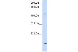 WB Suggested Anti-CETP Antibody Titration: 0. (CETP anticorps  (N-Term))
