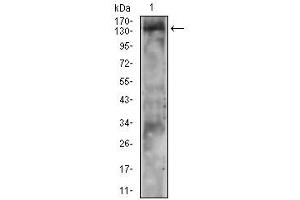 Western Blotting (WB) image for anti-Phospholipase C gamma 2 (PLCG2) (Tyr753) antibody (ABIN5864903) (Phospholipase C gamma 2 anticorps  (Tyr753))